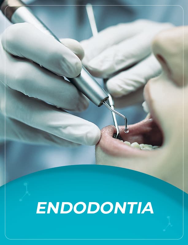 ENDODONTIA